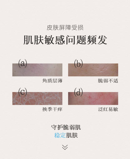Blé de Fonty 紫草面部保濕舒緩膠囊精华 0.33ml*21粒