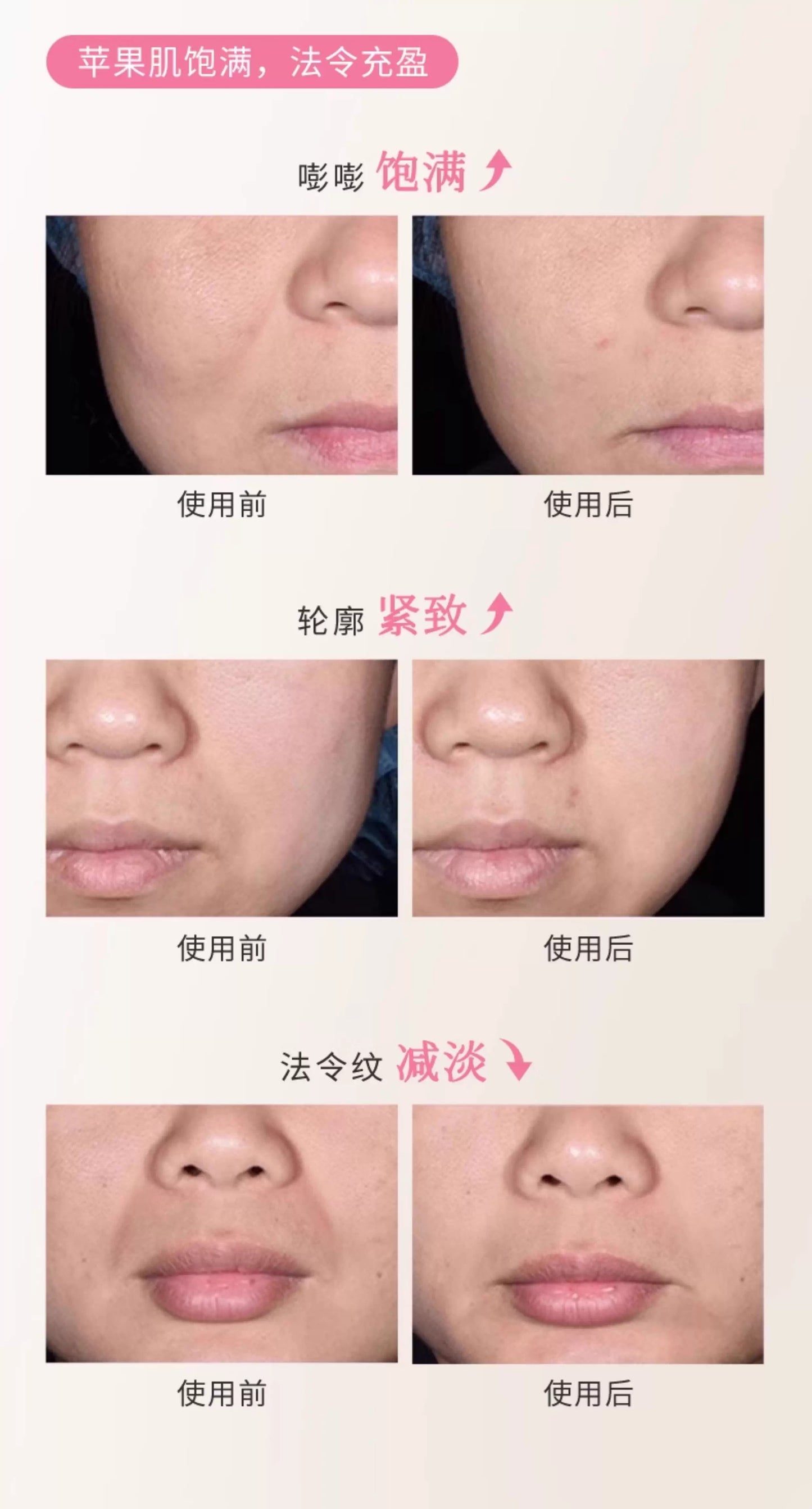 Blé De Fonty 面中豐盈緊塑美容膠囊精華油法令紋蘋果肌下垂 (0.25ml*30粒)