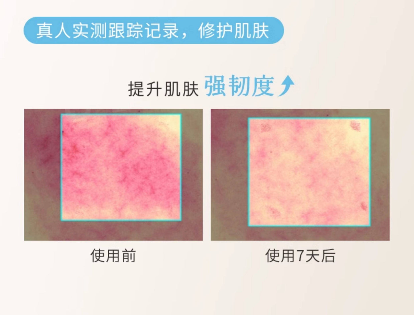 Blé de Fonty 紫草面部保濕舒緩膠囊精华 0.33ml*21粒